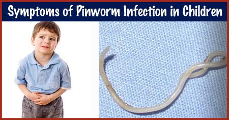 Pinworm Rash