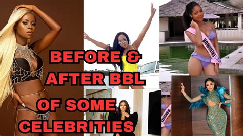 5 CELEBRITIES THAT HAVE OPENLY ADMITTED TO GETTING A BBL SURGERY. - YouTube