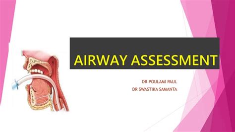 AIRWAY ASSESSMENT FINAL.pptx