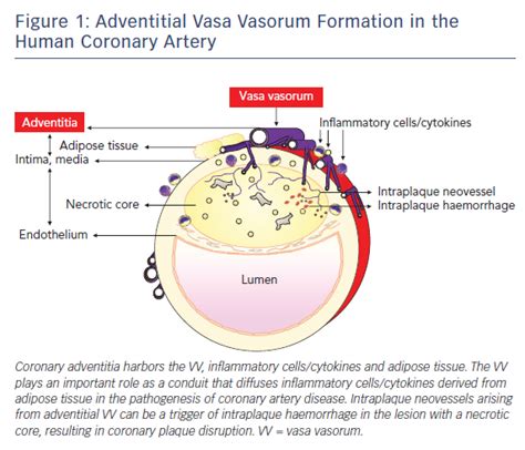 Viewpoint: Recent Advances in Intracoronary Imaging for Vasa Vasorum ...