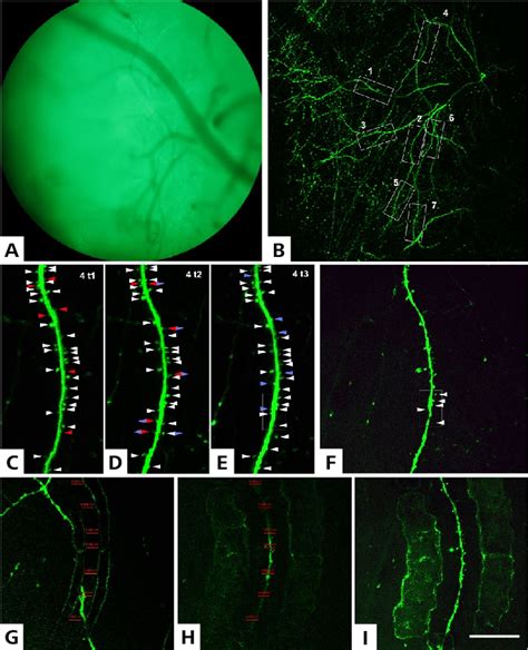 Two-photon imaging of mouse brain neurons in living mice. (Bars: A ...