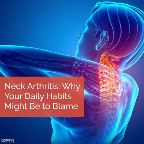 Neck Arthritis: Why Your Daily Habits Might Be to Blame - Sundial Clinics