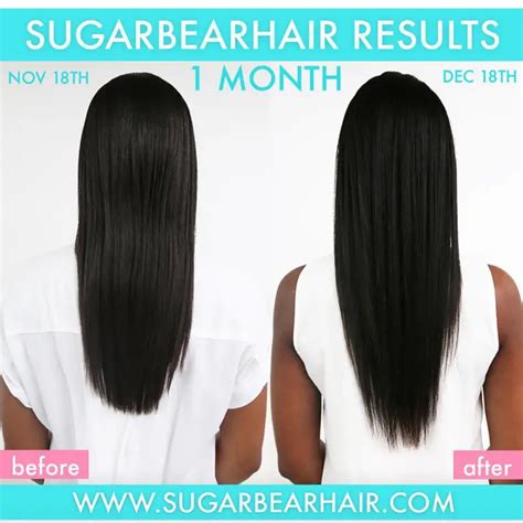 Sugar Bear Hair – Before and After, Ingredients & Side Effects – Review - Live Beauty Health