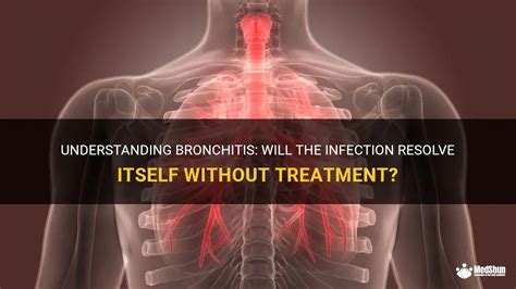 Understanding Bronchitis: Will The Infection Resolve Itself Without ...