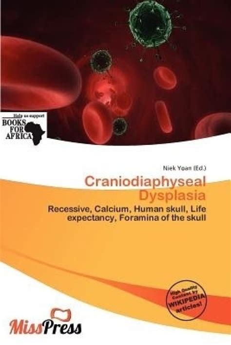 Craniodiaphyseal Dysplasia Skull