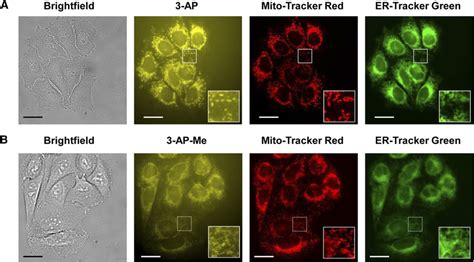 Live cell fluorescence microscopy images of SW480 colon carcinoma ...