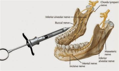 firstplatformforbds: MANDIBLE LANDMARKS AND POSITION OF NERVES FOR INFERIOR ALVEOLAR NERVE BLOCK ...