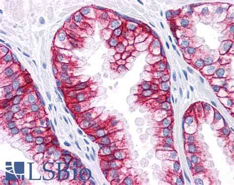 IHC-plus™ EPCAM Monoclonal Antibody Mouse anti-Human | LSBio