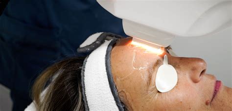 IPL Therapy: A Non-Invasive Treatment for Skin Rejuvenation