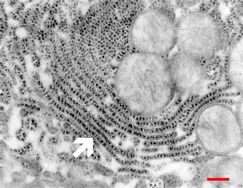 Glycogen granules Copyright © J Spacek | Atlas