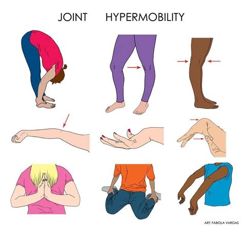 All Flex and No Pecs? Why Hypermobile Bodies Need Pilates — Kirsti ...