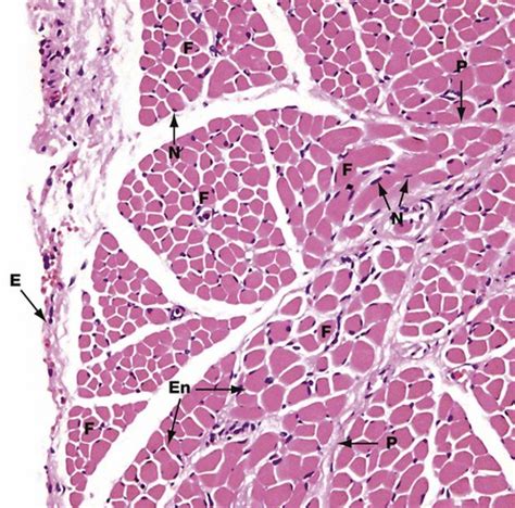 Muscle | Basicmedical Key