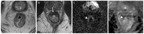 JCM | Free Full-Text | Advances in MRI-Based Assessment of Rectal ...