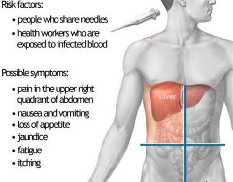 Autoimmune Hepatitis Causes Cirrhosis of the Liver - HealthProAdvice