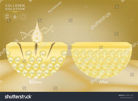 Hyaluronic Acid Before After Skin Solutions Stock Vector (Royalty Free) 1954011532 | Shutterstock