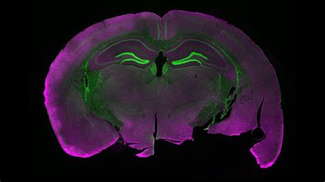 Never-before-seen brain cells discovered in mice. They're called gorditas. | Live Science