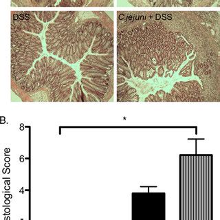 C. jejuni infection increases the severity of histological inflammation ...