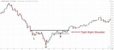 Inverse Head and Shoulders Pattern Trading Strategy Guide