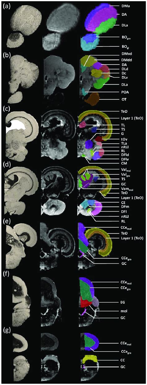 Comparison between Nissl stained histology sections (a) and MRI... | Download Scientific Diagram