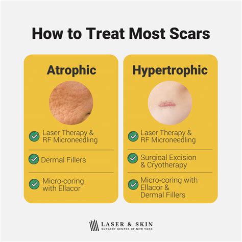 Best treatments for all types of scars explained - Laser NY