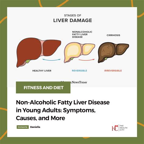 TheHealthCity - Non-Alcoholic Fatty Liver Disease In Young Adults ...