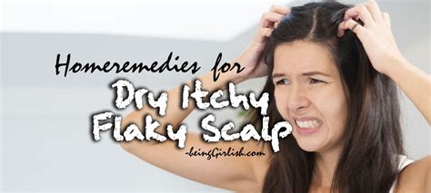 Home Remedies For Dry Itchy Flaky Scalp | Being Girlish