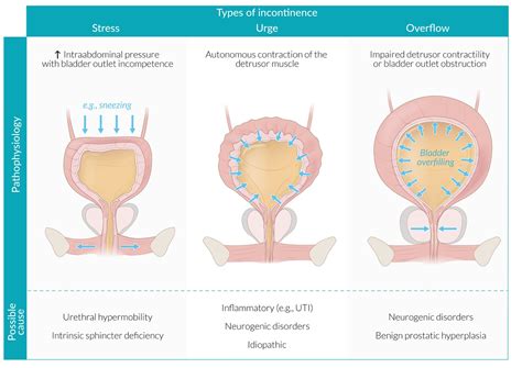 Solve Incontinence With Yoga And Anatomy — Andrea Trombley Physical Therapy And Yoga | atelier ...