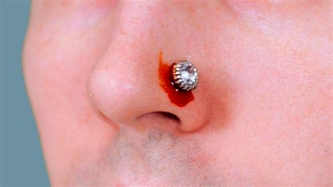 Nose Piercing Gone Wrong