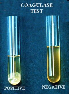 Coagulase Test: Principle, Procedure, Results – Microbe Online