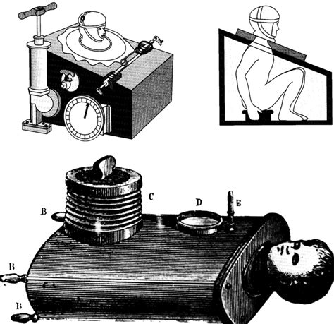 The Mechanical Ventilator: Past, Present, and Future | Respiratory Care