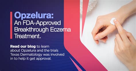 Opzelura: A Breakthrough Topical in Dermatology