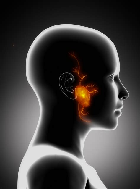 Parotid Gland Tumor - Net Health Book