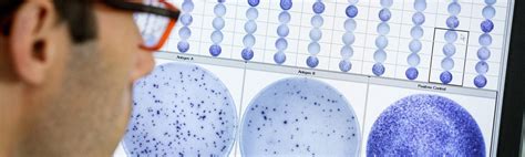 The T-SPOT.TB test technology | The T-SPOT.TB test