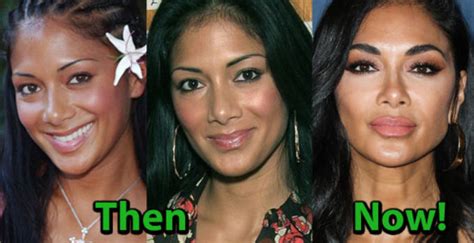 Nicole Scherzinger Plastic Surgery: Nose, Lips, Boobs ...