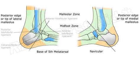 Ankle Injuries — REAL First Aid