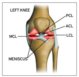 The difference between ACL and MCL injuries - Sports Medicine Weekly