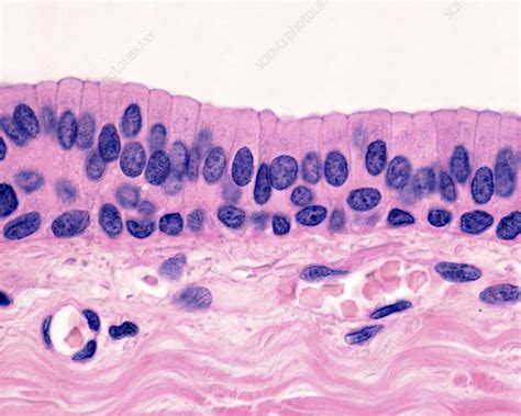 Stratified Columnar