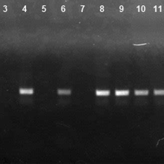 Genomic RNA protection assay by treatment with benzonase endonuclease.... | Download Scientific ...