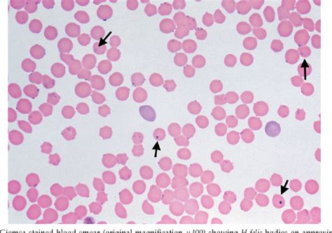 Figure 2 from Haemobartonella Felis: Recent Developments in Diagnosis and Treatment | Semantic ...