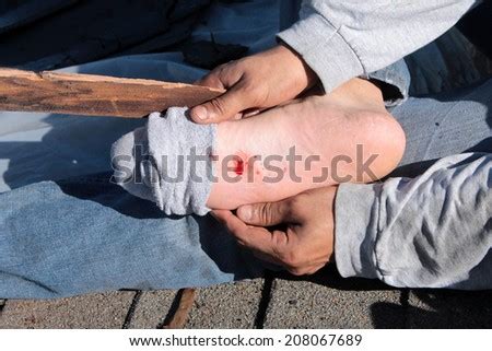 Puncture Wound Stock Images, Royalty-Free Images & Vectors | Shutterstock