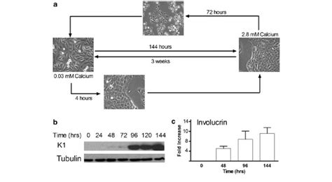 HaCaT differentiation model: (a) Phase contrast images showing the ...