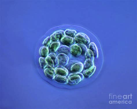 Eudorina Algal Colony Photograph by Marek Mis/science Photo Library ...