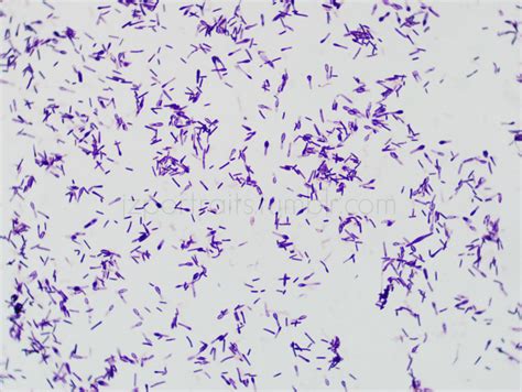 Judy Z - Gram Stain: Clostridium tertium Gram positive rod...