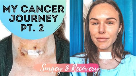 My Thyroid Cancer Journey || Part 2 - Surgery & recovery - YouTube