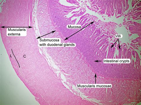 Duodenum Slide Labeled