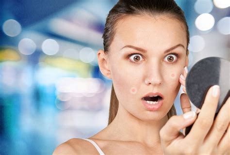 Large Pores and Acne: What’s the Connection? - ReliableRxPharmacy Blog, Health Blog