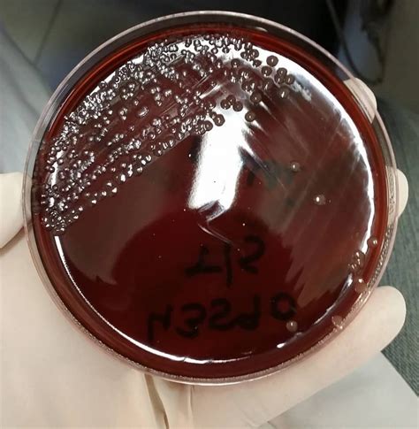 Morphology & Culture Characteristics of Neisseria meningitidis (Meningococcus)