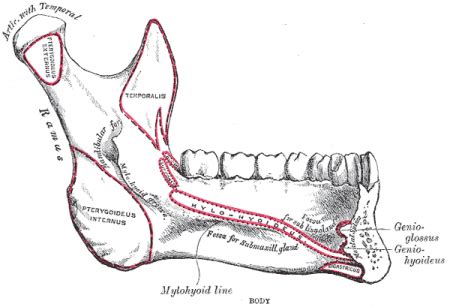 Mandible fracture - WikEM