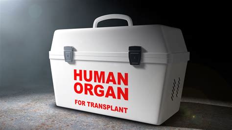 What happens to your body when you're an organ donor? | Live Science