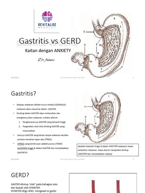 Gastritis Vs GERD | PDF